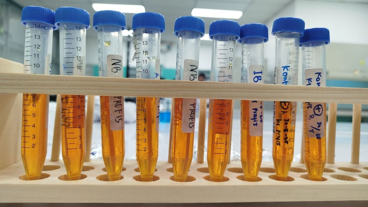 membongkar-jejak-warna-tekstil-di-citarum-penelitian-mahasiswa-mikrobiologi-itb-dengan-bakteri-pendegradasi